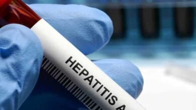 Brote hepatitis A