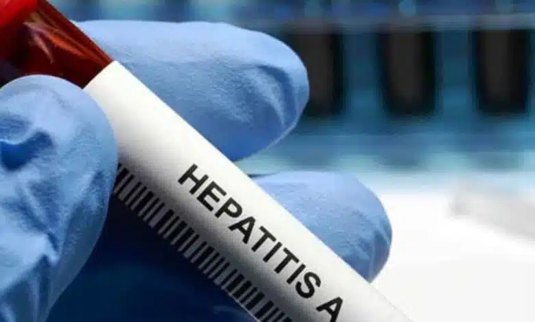 Brote hepatitis A