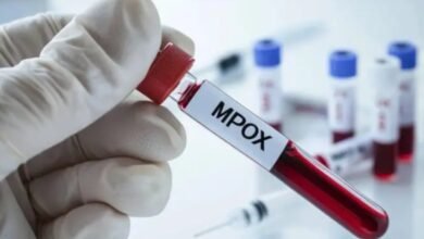 ¿Cómo se contagia la Viruela del Mono? ¿Se puede morir de Mpox? Esto debes saber